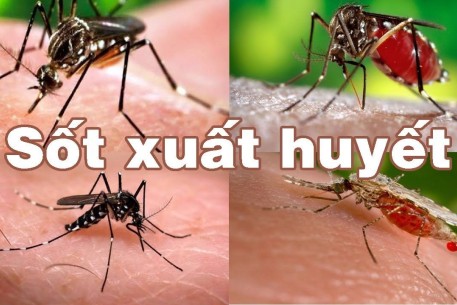 Hiểu về muỗi vằn để phòng chống sốt xuất huyết hiệu quả