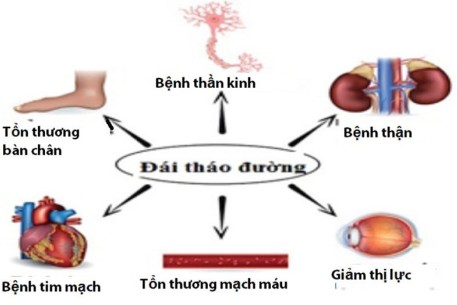 Bệnh Đái tháo đường và các biện pháp phòng ngừa