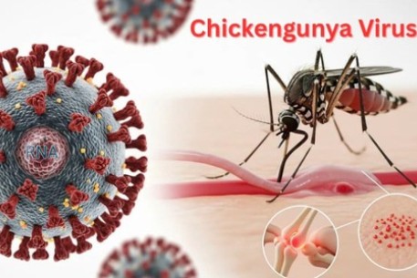Không hoang mang nhưng cũng không chủ quan với Chikungunya