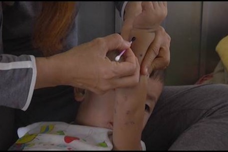 Khẩn trương ứng phó với bệnh Tay chân miệng đang tăng mạnh