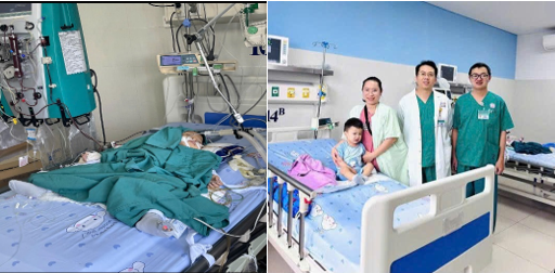Bệnh nhi được điều trị hồi sức tích cực và sức khỏe dần ổn định 